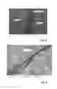 Fig. 04 - COATED STENT