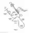 Fig. 02 - MULTIPLE DRUG DELIVERY FROM A BALLOON AND A PROSTHESIS