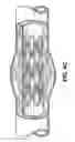 Fig. 06 - MULTIPLE DRUG DELIVERY FROM A BALLOON AND A PROSTHESIS