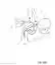 Fig. 24 - Device and method for collecting and dispensing colostrum