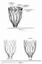 Fig. 05 - Biphasic and dynamic adjustable support devices and methods with assist and recoil capabilities for treatment of cardiac pathologies