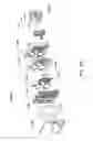 Fig. 115 - Cassette system integrated apparatus