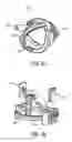 Fig. 181 - BLOOD TREATMENT SYSTEMS AND METHODS