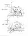 Fig. 22 - Puncture device and medical fluid administration device