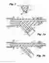Fig. 05 - System having multiple pneumatically sealed trocars