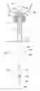 Fig. 01 - Indwelling urinary catheter