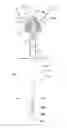 Fig. 02 - Indwelling urinary catheter
