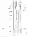 Fig. 16 - Indwelling urinary catheter