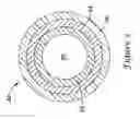 Fig. 06 - Adjustable stiffness catheter