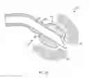 Fig. 06 - Interventional sinus endoscope