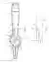 Fig. 08 - Catheter deflection actuator providing mechanical advantage