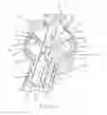 Fig. 10 - Catheter deflection actuator providing mechanical advantage