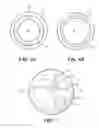 Fig. 07 - Balloon catheter with fluid injection elements