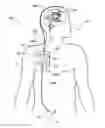 Fig. 01 - Body fluid drainage system