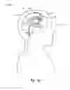 Fig. 09 - Body fluid drainage system