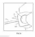 Fig. 05 - Buttonhole tool