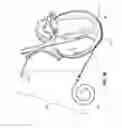 Fig. 03 - EPICARDIAL LEAD PLACEMENT APPARATUS, SYSTEMS, AND METHODS