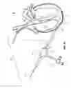 Fig. 04 - EPICARDIAL LEAD PLACEMENT APPARATUS, SYSTEMS, AND METHODS