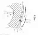 Fig. 07 - EPICARDIAL LEAD PLACEMENT APPARATUS, SYSTEMS, AND METHODS