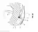 Fig. 08 - EPICARDIAL LEAD PLACEMENT APPARATUS, SYSTEMS, AND METHODS