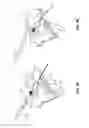 Fig. 09 - EPICARDIAL LEAD PLACEMENT APPARATUS, SYSTEMS, AND METHODS