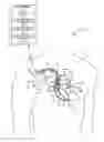 Fig. 01 - Bi-atrial synchronized left ventricular cardiac pacing