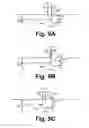 Fig. 10 - Bi-atrial synchronized left ventricular cardiac pacing