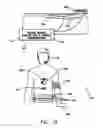 Fig. 02 - Wireless closed-loop and system to detect and treat sleep apnea
