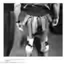 Fig. 03 - HAMSTRONG PROSTHETIC HAMSTRING/ POST CHAIN BRACE
