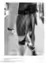 Fig. 04 - HAMSTRONG PROSTHETIC HAMSTRING/ POST CHAIN BRACE