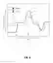 Fig. 07 - Device and method for sensing, guiding, and/or tracking pelvic exercise