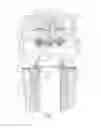 Fig. 03 - Filter device
