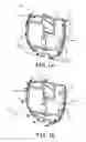 Fig. 02 - Frames for implantable medical devices and methods