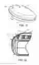 Fig. 05 - Frames for implantable medical devices and methods