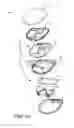 Fig. 06 - Frames for implantable medical devices and methods