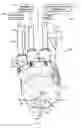 Fig. 01 - High-pressure waterjet cutting head systems, components and related methods