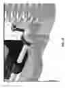 Fig. 18 - SUSPENSION FOR A MULTIPLE HEIGHT VEHICLE
