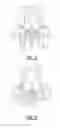 Fig. 05 - Windscreen wiper device