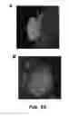 Fig. 43 - Compounds and methods for treating bacterial infections