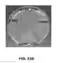 Fig. 87 - Compounds and methods for treating bacterial infections