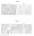 Fig. 04 - TUMOR SPECIFIC ANTIBODY