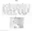 Fig. 06 - TUMOR SPECIFIC ANTIBODY