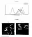 Fig. 07 - TUMOR SPECIFIC ANTIBODY
