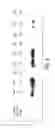 Fig. 04 - PSMA ANTIBODIES AND USES THEREOF