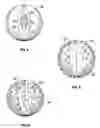 Fig. 04 - Polyurethane gel particles, methods and use in flexible foams