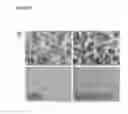 Fig. 06 - Method of Deriving Mesenchymal Stem Cells