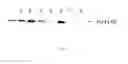 Fig. 11 - PROMOTERS FOR EXPRESSING A GENE IN A CELL