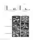 Fig. 06 - Method for controlling flowering time by regulating of SVP-FLM-β protein complex formation