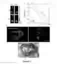 Fig. 03 - METHODS FOR BLADDER CANCER THERAPY USING BACULOVIRAL VECTORS