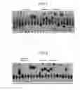 Fig. 03 - DNA encoding dipeptide-synthesizing enzyme (variants), bacterium belonging to the genus , and methods for producing dipeptides using thereof